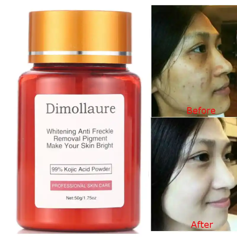 kojic eye cream