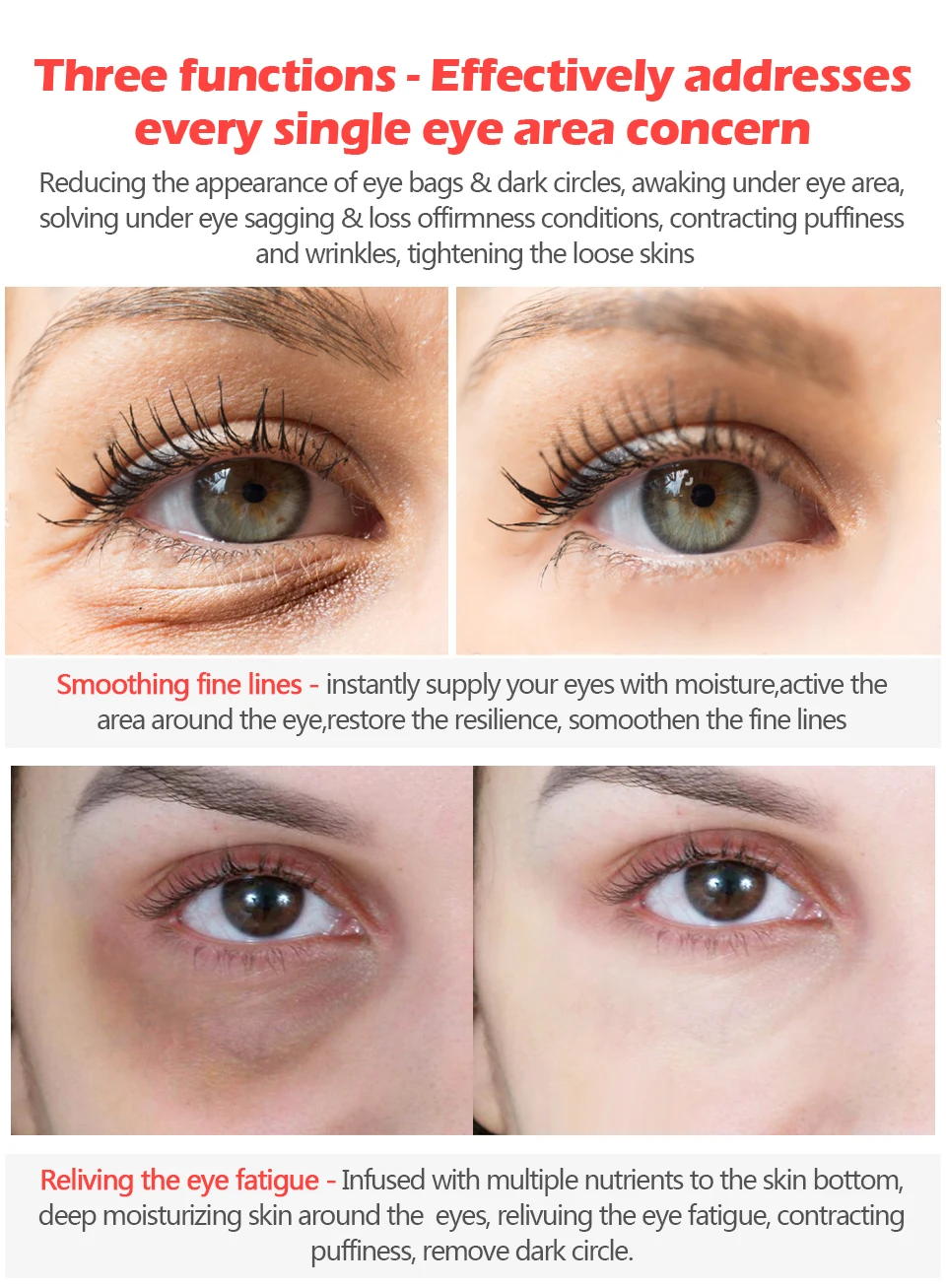 deep lines under eyes