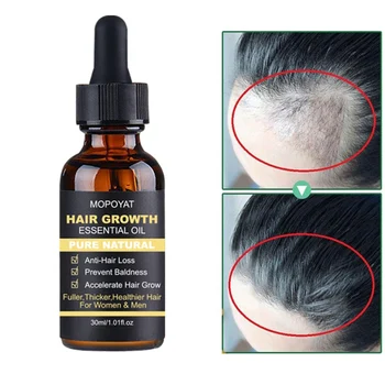 

30ml Hair Growth Essential Oil Anti Hair Loss Repair Damage Hair Growth Treatment Thick Root Repair Dry Hair Care Produc Q1