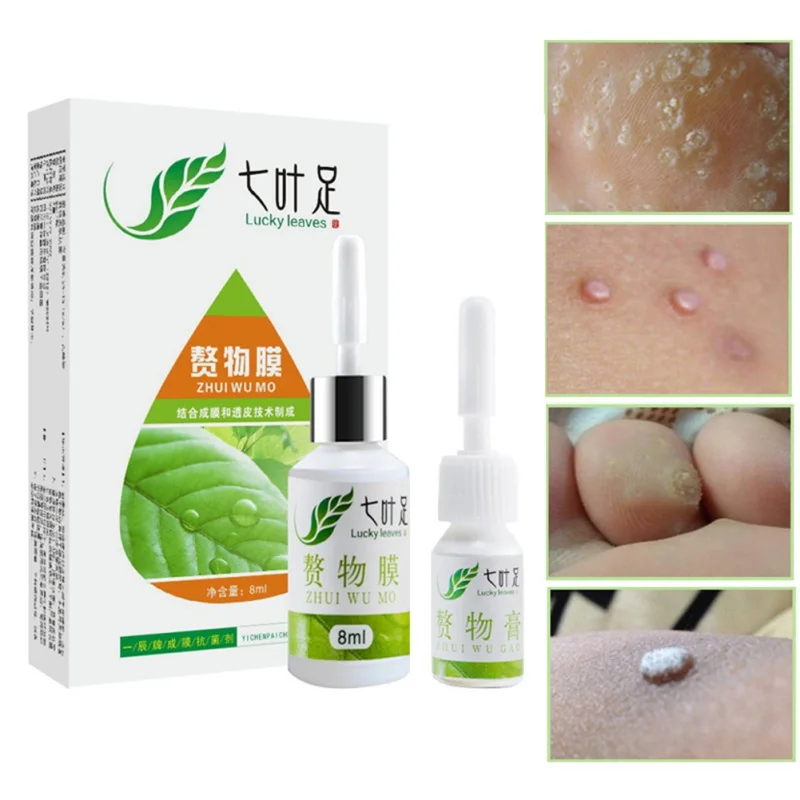 Mole& Skin Tag Repair Solution Painless Mole Skin Dark Spot Repair Face Wart Tag Verruca Treatment Essence skin tag remover tool Mole& Skin Tag Repair Solution Painless Mole Skin Dark Spot Repair Face Wart Tag Verruca Treatment Essence skin tag remover tool