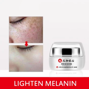 

Powerful Whitening Anti Freckle Cream Dark Spots Remover Face Whitening Cream Effectively Brightening Cream Skin Treatment TSLM2