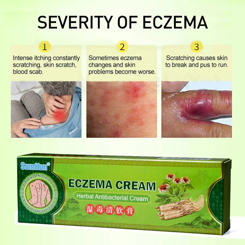 Sumifun 1Pcs Soft Eczema Cream 100% Herbal Anti-bacterial Ointment Chinese Antipruritic and Sterilizing Essential Oil K10002