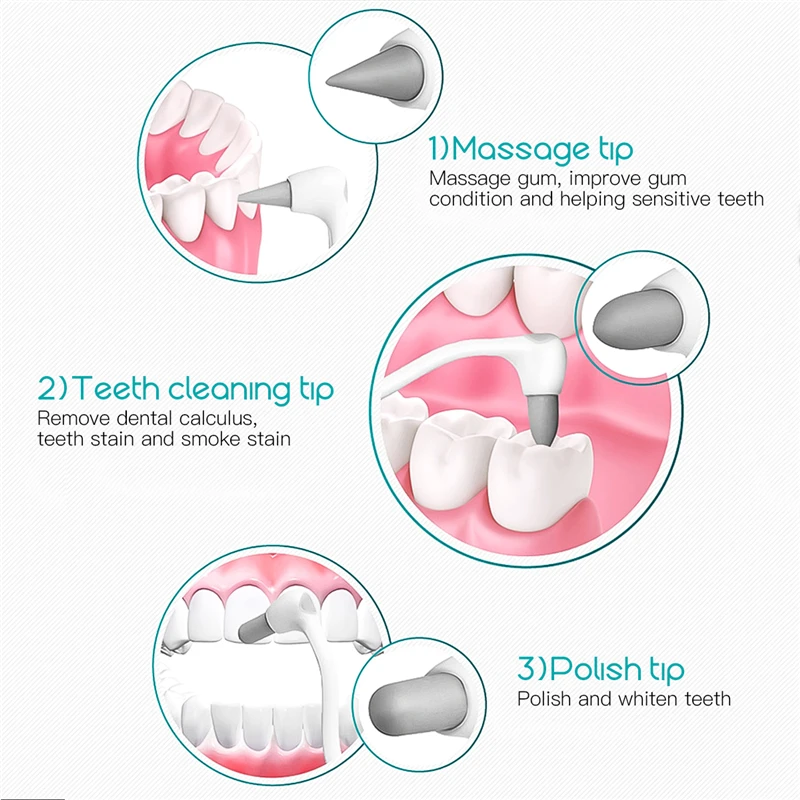 CkeyiN Электрический стоматологический инструмент ультразвуковое устройство для удаления зубного налета для удаления зубов отбеливание зубов инструменты для очистки