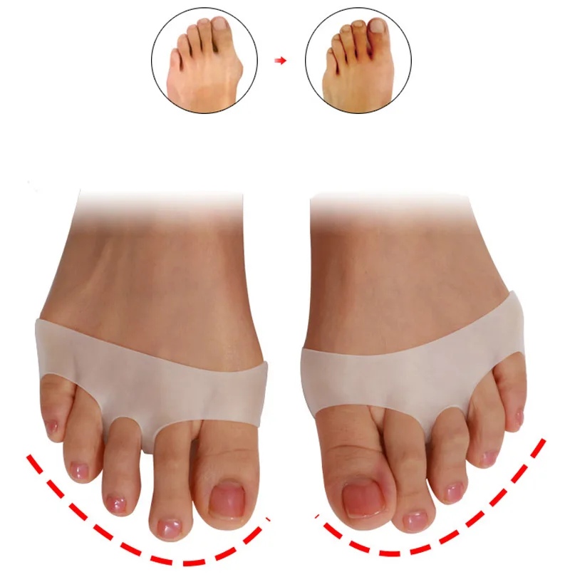1Pair=2Pcs Toe Separator Orthopedic Products Soft Silicone Non-slip Pedicure Pad Hallux Valgus Metatarsal Corrector Plantar