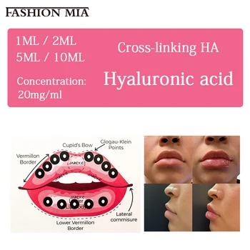 

Hot 1ml/2ml/5ml/10ml Lips Hyaluronic Acid Filler with Box