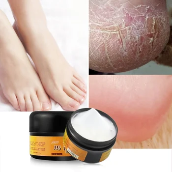 

Natural Horse Oil Foot Cream Moisturizing Skin Repairing Anti-Chapping Improve Feet Heel Roughness Dryness