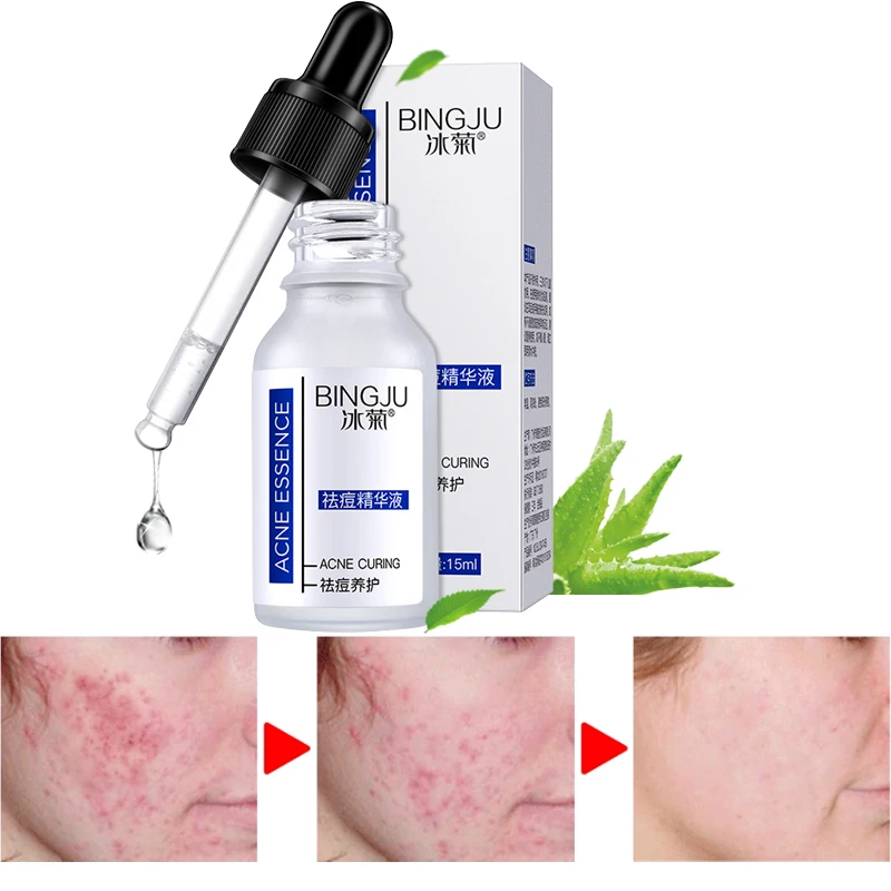 acne whitening serum