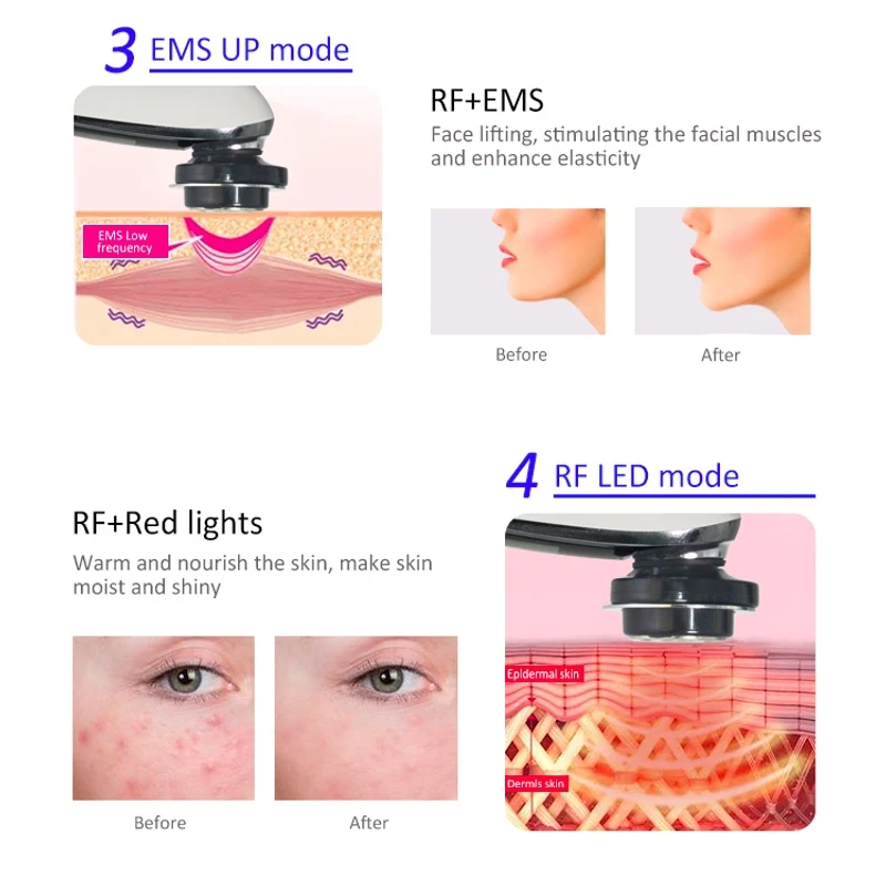  RF Radio Frequency Facial Machine With LED Therapy For Wrinkle Removal Face Lifting Skin Tightening - 32861875667