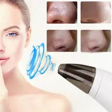 Бытовая электрическая черная головка для удаления, всасывающий поры лицо лечение акне прибор красоты s