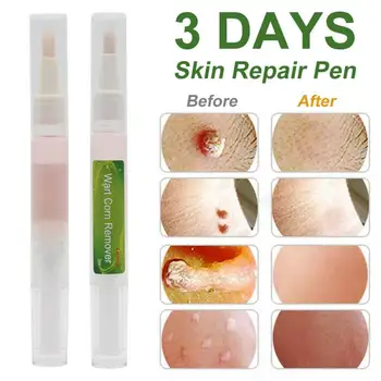 

Magic Skin Tag Remover Pen Wart Removal Pen Tag Removal Freckle Wart Dark Spot Remover Blackhead Removers Skin Care Tool