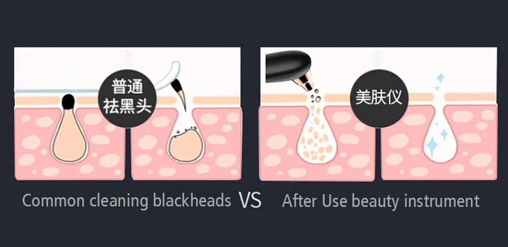 Vacuum Face Nose Pore Cleaner Electric Blackhead Remover Skin Care Hot Compress Pore Suction Tool Acne Pimple Removal Machine