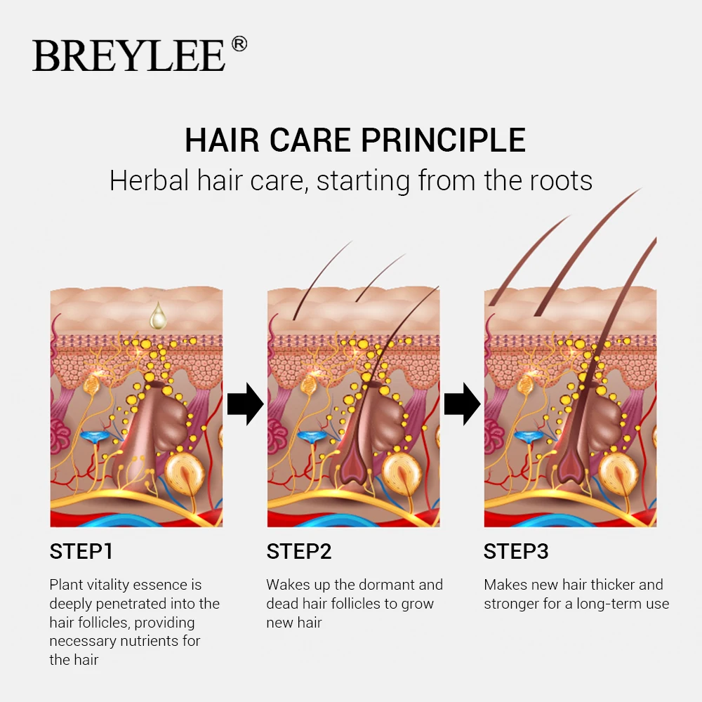 BREYLEE Hair Growth Essential Oil 20ml Fast Powerful Hair Products Hair Care Prevent Baldness Anti-Hair Loss Hair Serum Beauty (7)