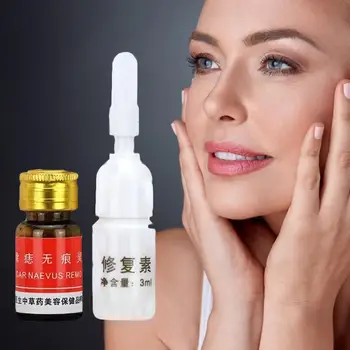 

30ML Mole Removal Cream Freckle Removal Cream Face Care Repair Solution Removal Solution Painless Professional Acne Treatment