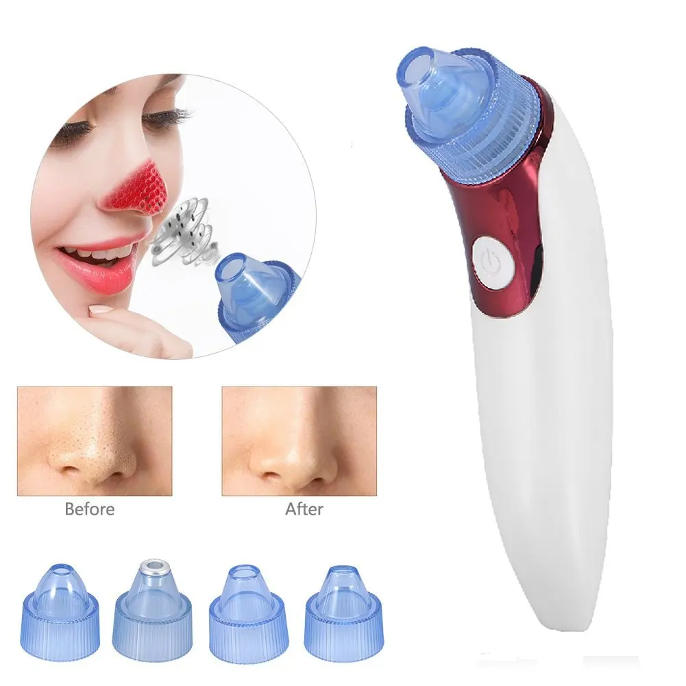 

Blackhead Remover Vacuum Facial Pore Cleanser Electric Acne Comedone Extractor Kit USB Rechargeable Blackhead Suction Tool