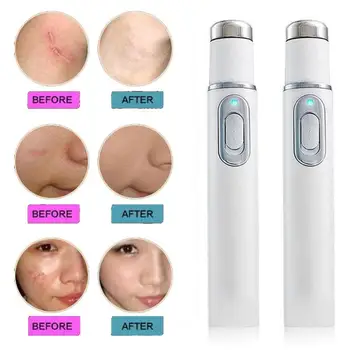 

Acne Laser Pen Portable Wrinkle Removal Machine Durable Soft Scar Remover Device Blue Light Therapy Pen Massage Relax Skin Care
