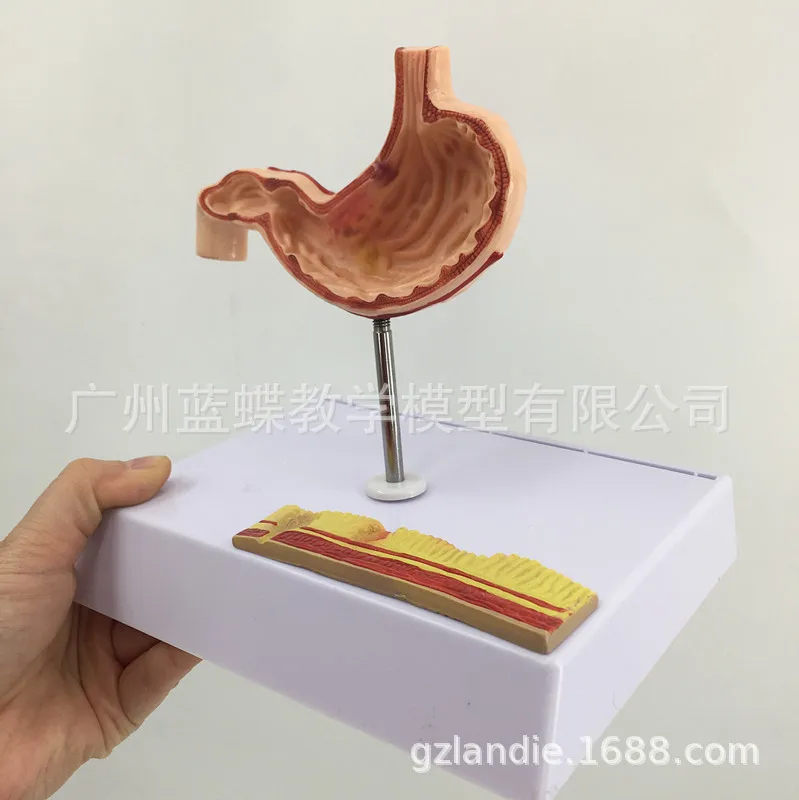 Human Stomach Lesions Model Have Base Medical Teaching Model Manufacturers Direct Selling
