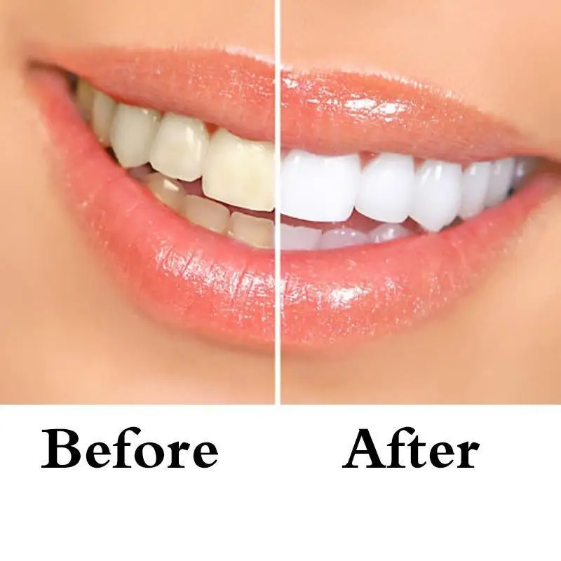 2019 Hot Sale White Teeth Whitening Pen 1pcs Genuine Quick Remove Stain Teeth Portable Whitening Pen 5