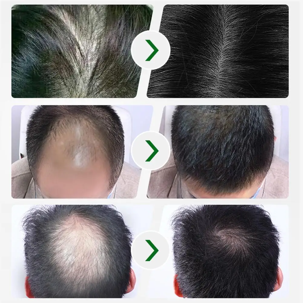 Средство против выпадения волос для мужчин, жидкий спрей с эфирным маслом, питает корни, натуральные средства для ухода за волосами для мужчин и женщин