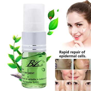 

Mole Skin Dark Spot Removal Gel Painless Face Wart Tag Freckle Removal Repair Cream NShopping