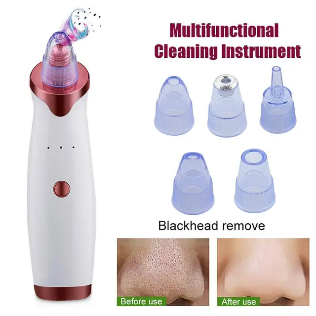 $US $6.81 Charing Facial Clean Blackhead Removal Equipment White Fast Fashion Effective Skin Care