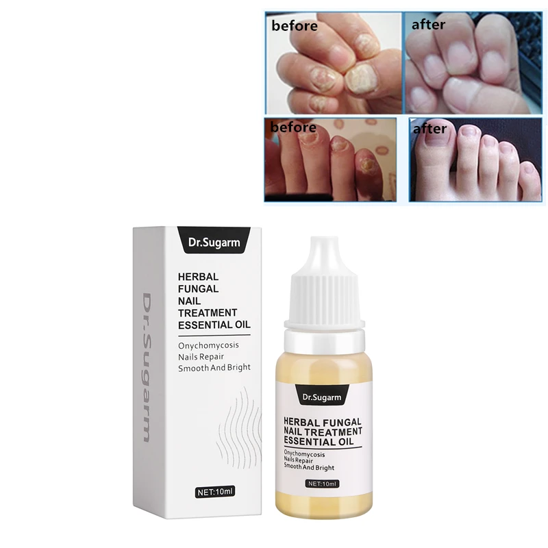Dr Sugarm Fungal Nail Treatment Feet Care Essence Herb Antibacterial Onychomycosis Paronychia Anti Infection Toe Nail 3