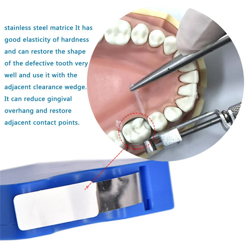 Стоматологическая нержавеющая сталь/полиэфирная пленка для реставрации световых излечиваемых смолы прозрачные Матричные полосы 5 мм/6 мм/7 мм ширина 0,025 мм Матричные полосы