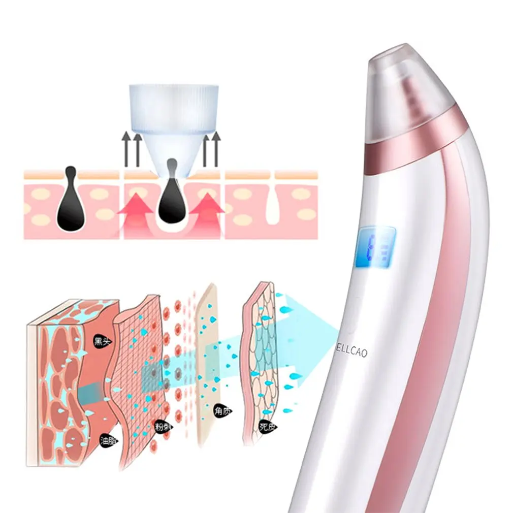Blackhead Artifact Electric Blackhead Instrument Pore Cleansing Artifact Cleansing Instrument Blackhead