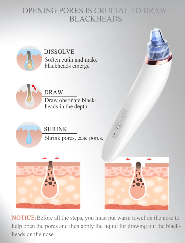 treading products electric blackhead removal skin care device
