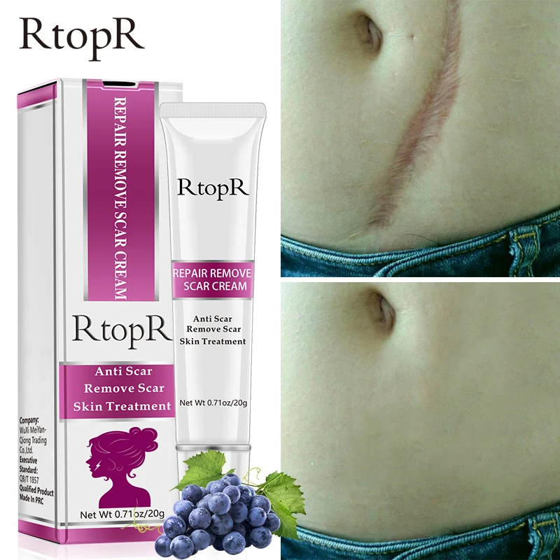 10 шт. RtopR крем для лица быстро эффективно удаляет шрамы от акне Глубокий Уход