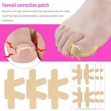 

5 Sheet/Set Ingrown Toenail Corrector Stickers Orthodontic Paronychia Treatment Recover Patches Toe Fingernail Foot Care Tool