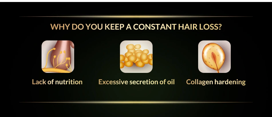 OMYLADY жидкое эфирное масло для роста волос, сыворотка,, Подлинная, против выпадения волос, плотный уход за ростом волос, новинка
