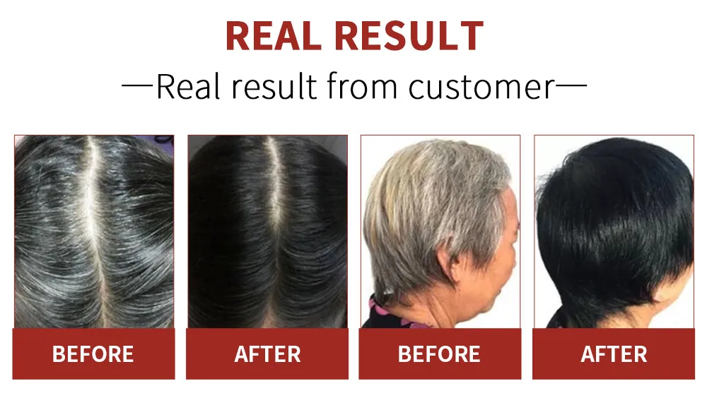 Эффект цвет волос перманентное лечение черных волос масло для волос против серой сыворотки белая эссенция для удаления покрытия серых волос китайская медицина