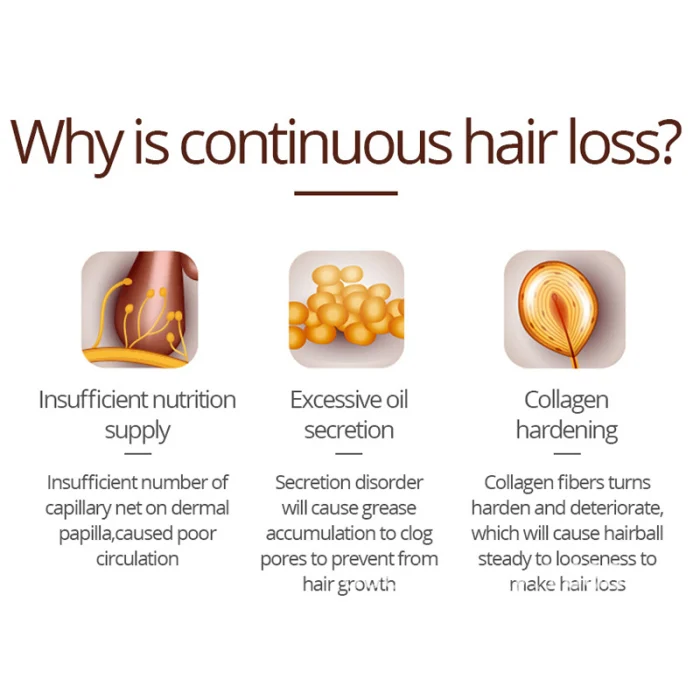 Hair Growth Essence Oil Liquid Spray Nourish Roots Thick Shiny Hair Anti-Loss for Men Women