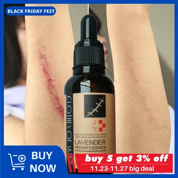 

Lavender Extract Stretch Marks Remove Scars and Stretch Marks Maternity Skin Body Repair Cream Postpartum Scars Care Essence