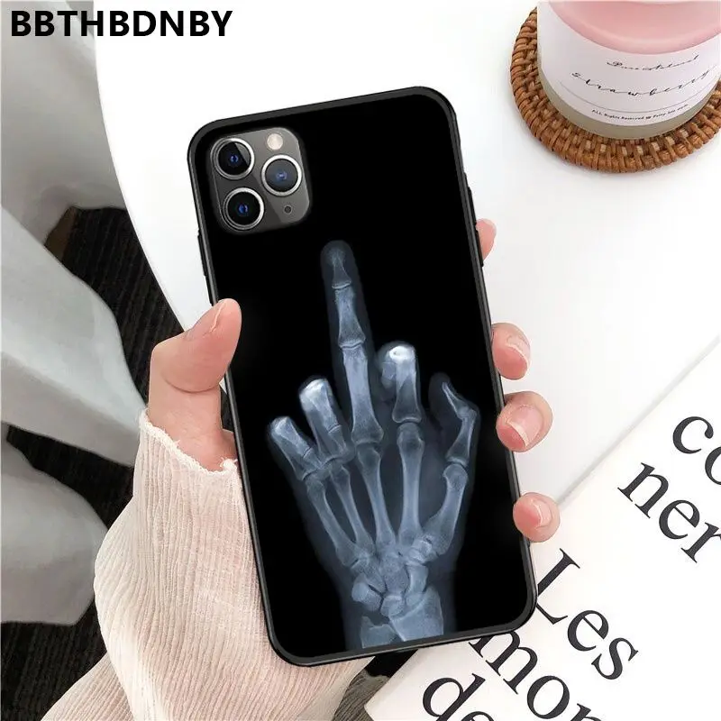 For iPhone X carcasa para iphone 11