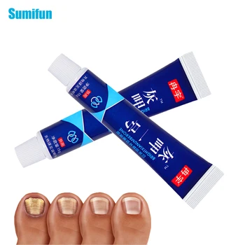 

Sumifun 1pcs Dead Nail Repair Treatment Ointment Dead Skin Removal Gel Anti Infection Fungus Onychomycosis Cream