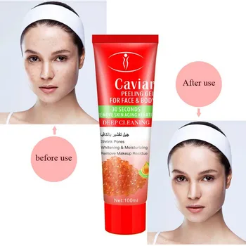 

Caviar Exfoliating Gel Moisturizing Moisturizing Repair Lightening Fine Lines Moisturizing Exfoliating Dead Skin Gel 100g
