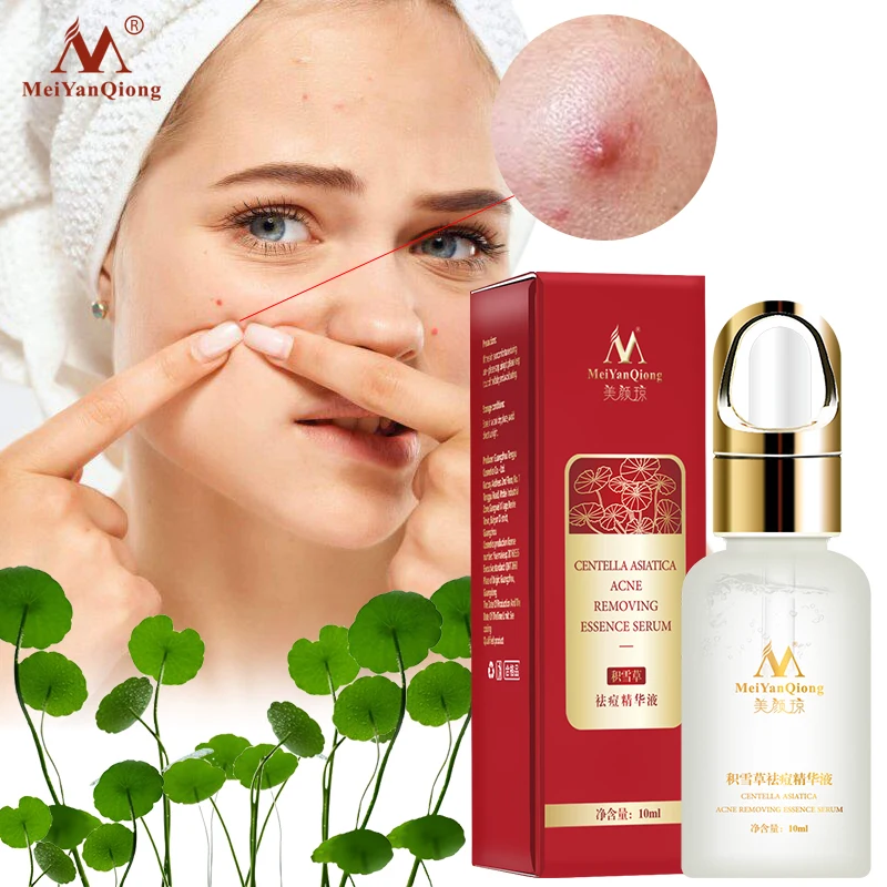 m skin care acne control serum