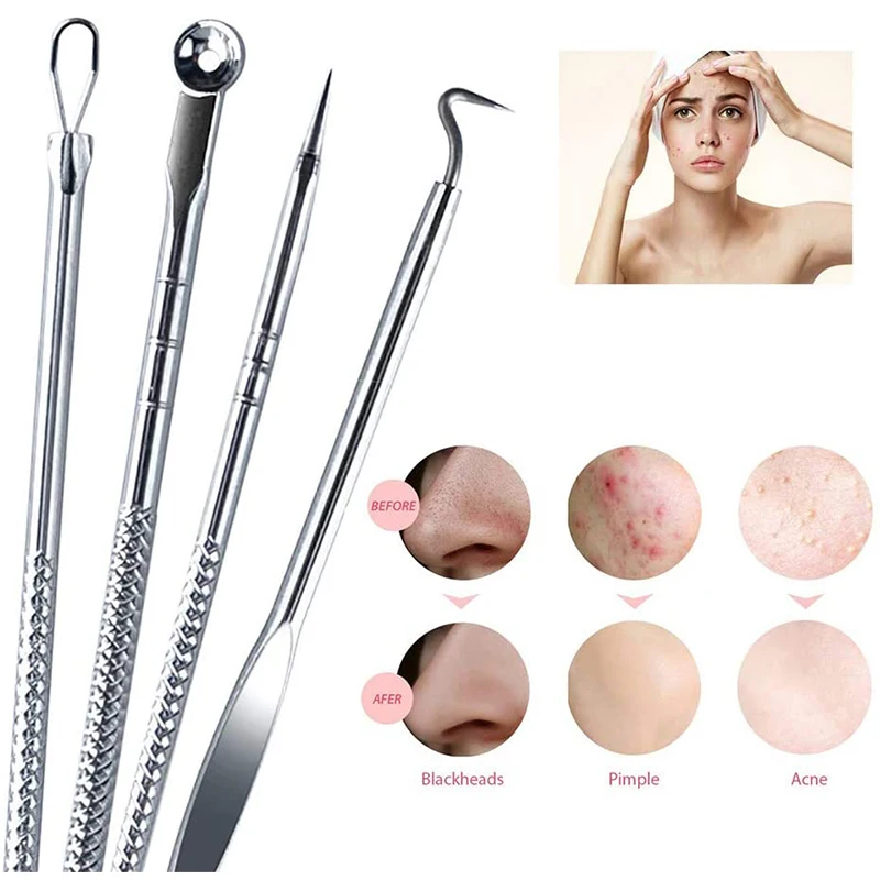 4Pcs Face Cleaner Rose Gold Stainless Steel Acne Blackhead Needle Set Facial Acne Remover Pick Health and Beauty Skin Care Tools 6