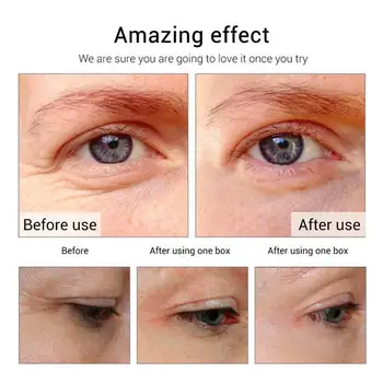 

5Pcs Moisturizing Repairing Mung Bean Eye Mask Hydrating Circles Eyes Patch Care Dark Anti-puffiness Eye K6E7