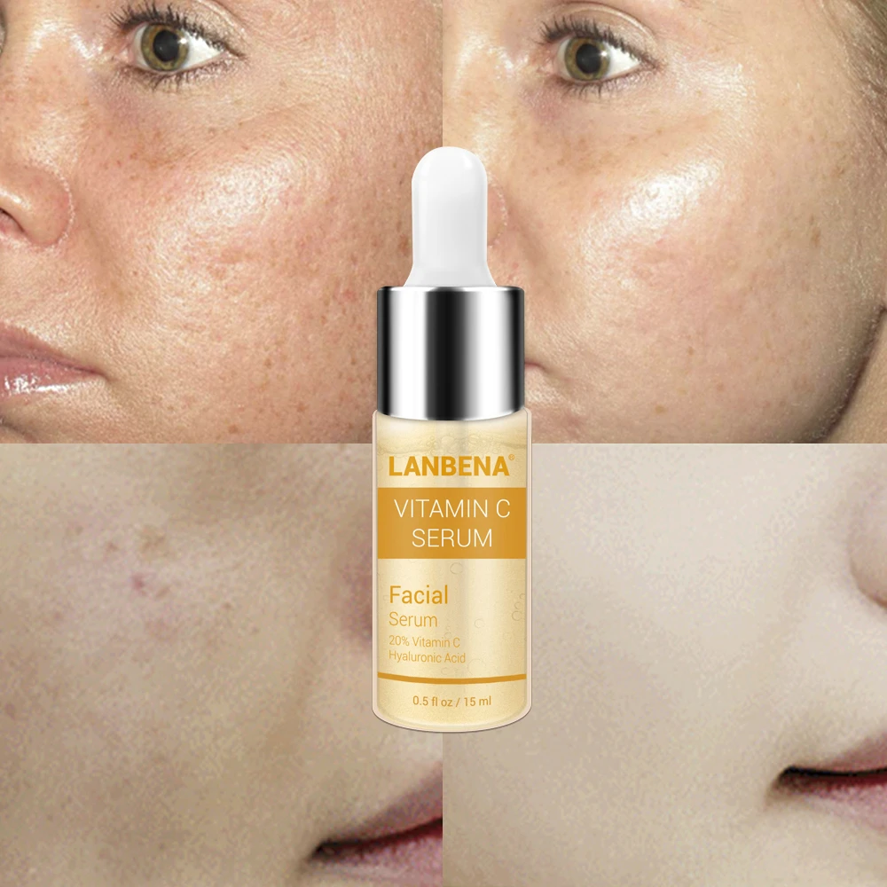 

LANBENA Vitamin C Whitening Serum Snail Hyaluronic Acid Face Cream Remover Freckle Speckle Fade Dark Spots Anti-Aging Skin Care