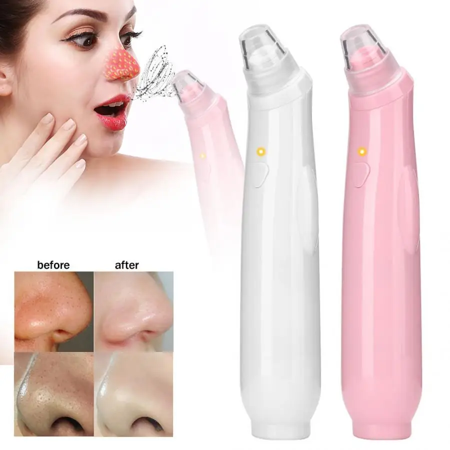 Портативное электрическое всасывание Удаление угрей очищает поры лица очищающий массажный аппарат для удаления угрей уход за кожей 4