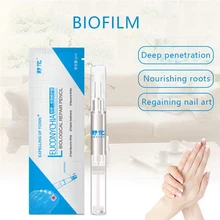Профессиональный 2 мл Лечение ногтей от грибка ног Дезинфекция Рук ногтей грибковое питающее масло ручка инструменты для маникюра