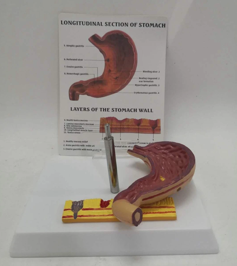 

Human Diseased Pathological Longitudinal Section of Stomach Anatomical Biology Medical Model Layer Stomach Wall