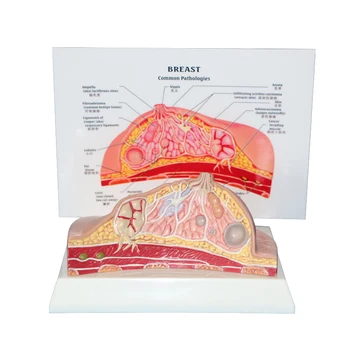 

Artificial Pathological Female Breast Anatomical Model