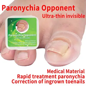 

2pcs/Box Ingrown Toe Nail Correction Sticker Patch Paronychia Invisible Nail Acronyx Orthotics Patch Foot Care Treatment