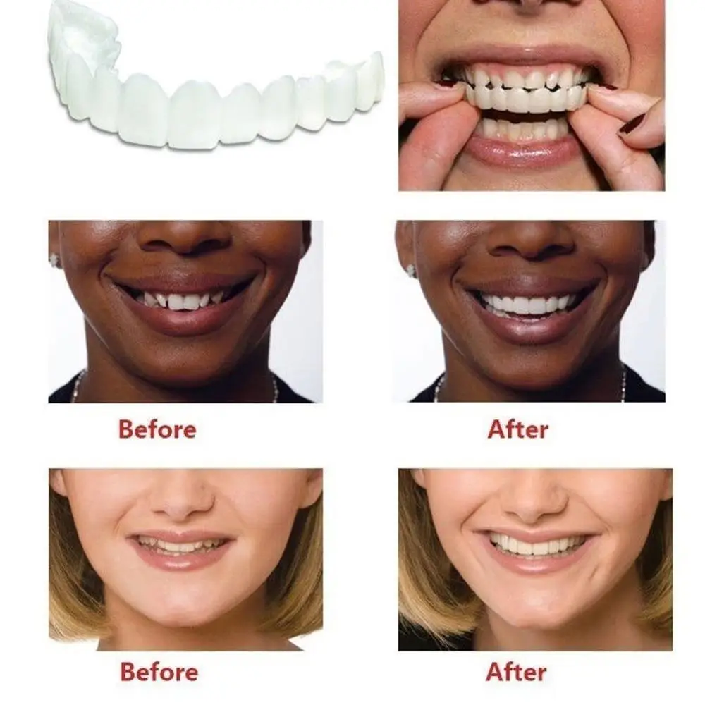 1 шт. зубной протез Smile Cosmetic Teeth удобный шпон покрытие верхнее отбеливание зубов оснастка на улыбку зубы косметические протезы