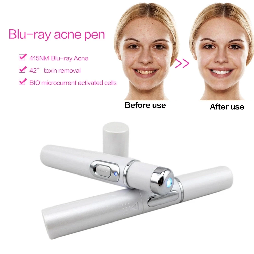 

Protable Blue Light Acne Treatment Pen BIO Current Aging Therapy Anti-Wrinkle Scar Varicose Veins Laser Pen for Varicose Veins