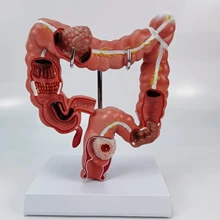 

Teaching Model Human Large Intestine Anatomical Model Visceral Colon and Rectum Pathological Model for School