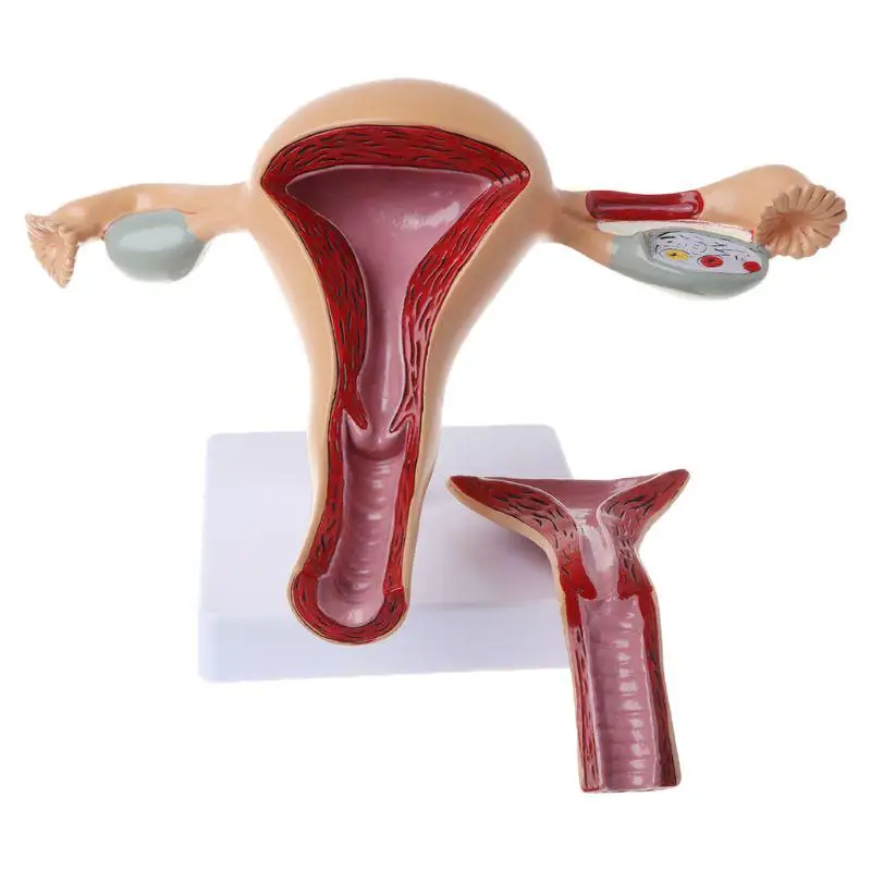 

Human Pathological Uterus Ovary Model Anatomical Anatomy Disease Pathology Medical Lesion Teaching tools